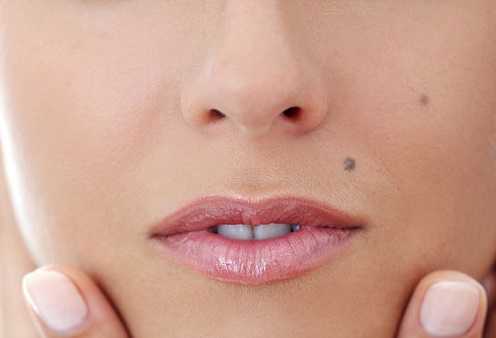 Facial Scars and Birthmarks
