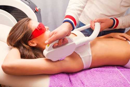 Laser for hair removal