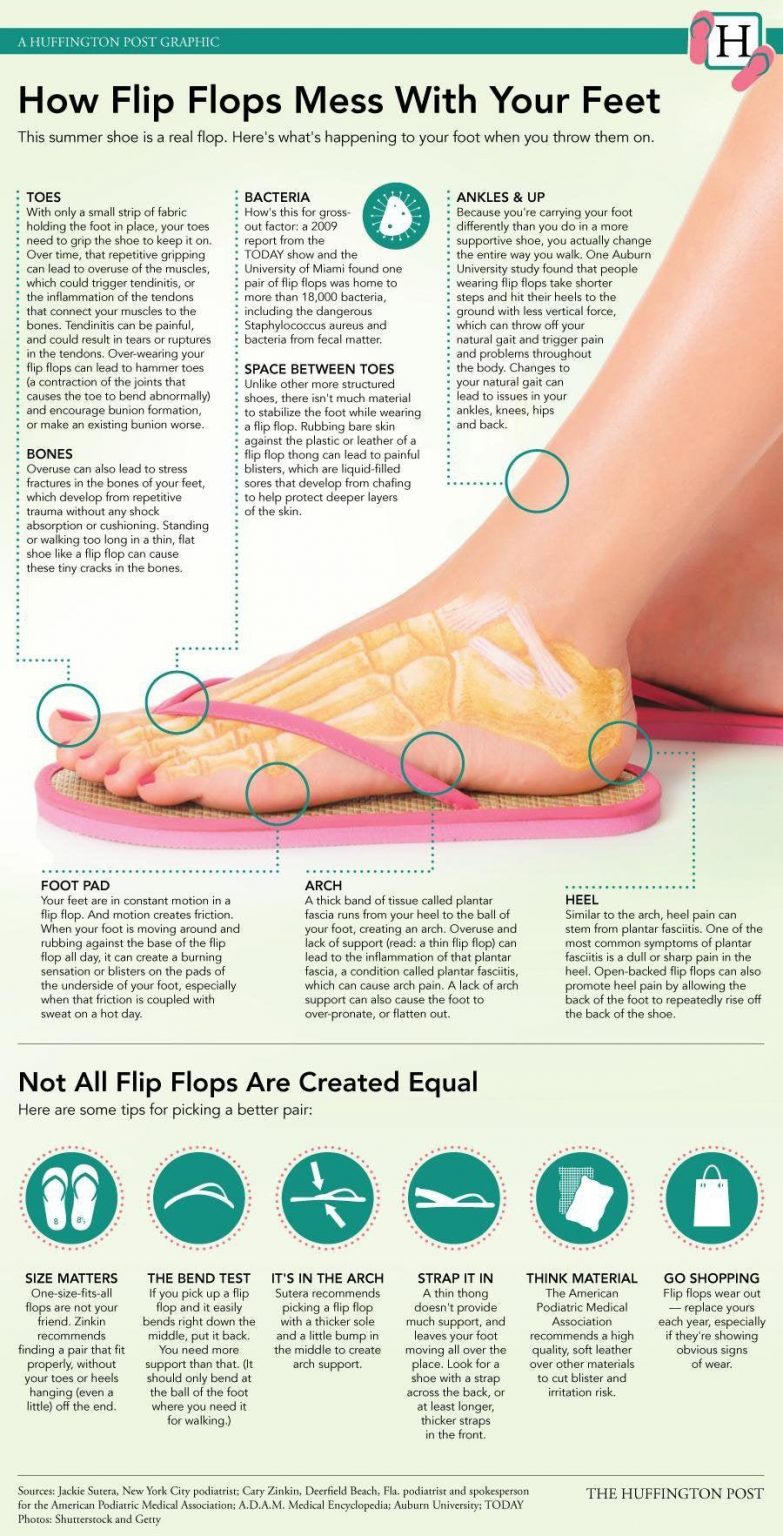 knee pain from wearing flip flops