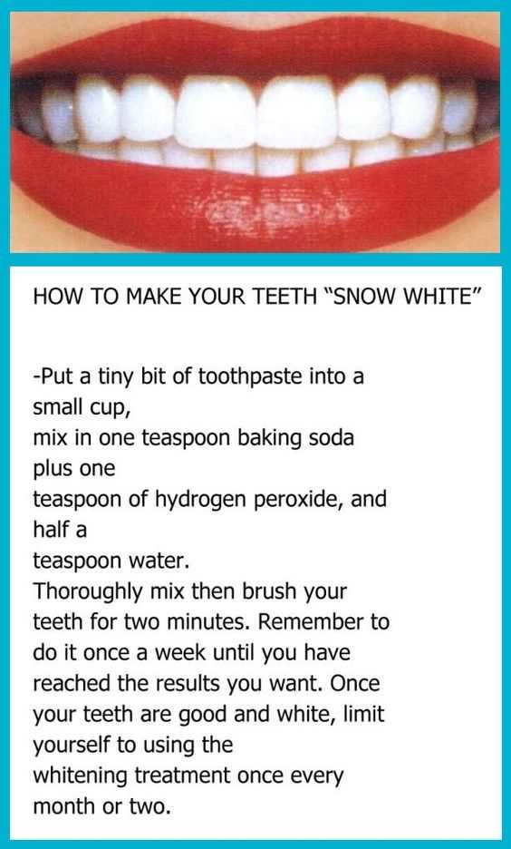 How To Make Your Teeth Snow White